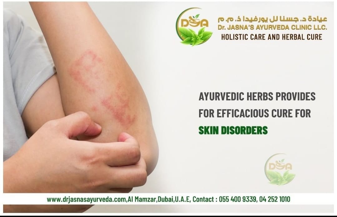 Ayurvedic Ways to Get Rid of Skin Allergies